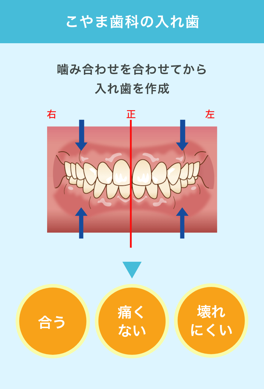 こやま歯科の入れ歯